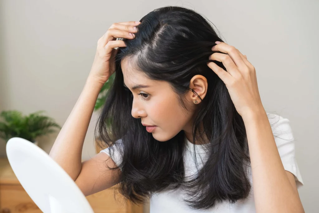 Thinning Hair Treatment