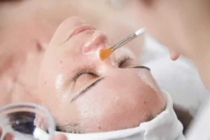 Chemical Peels in Sparta, NJ by Apres beauty and wellness LLC
