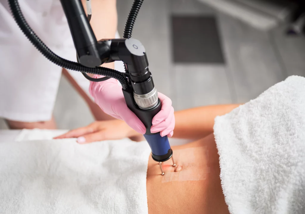 Cellulite Reduction Treatment in Sparta, NJ