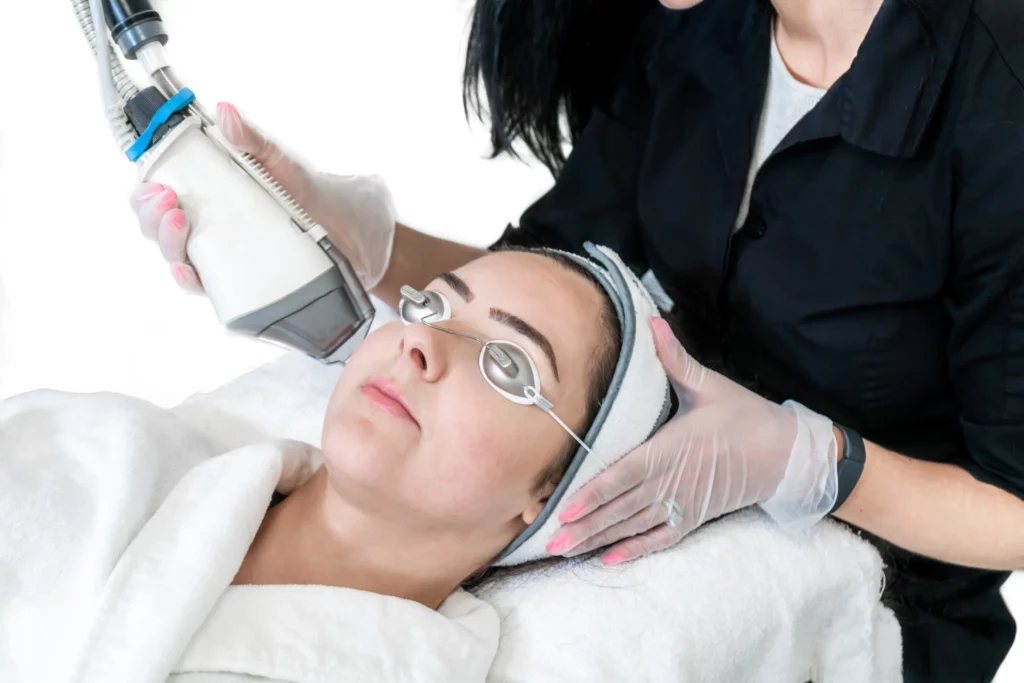 Acne Scar Removal Treatment in Sparta, NJ
