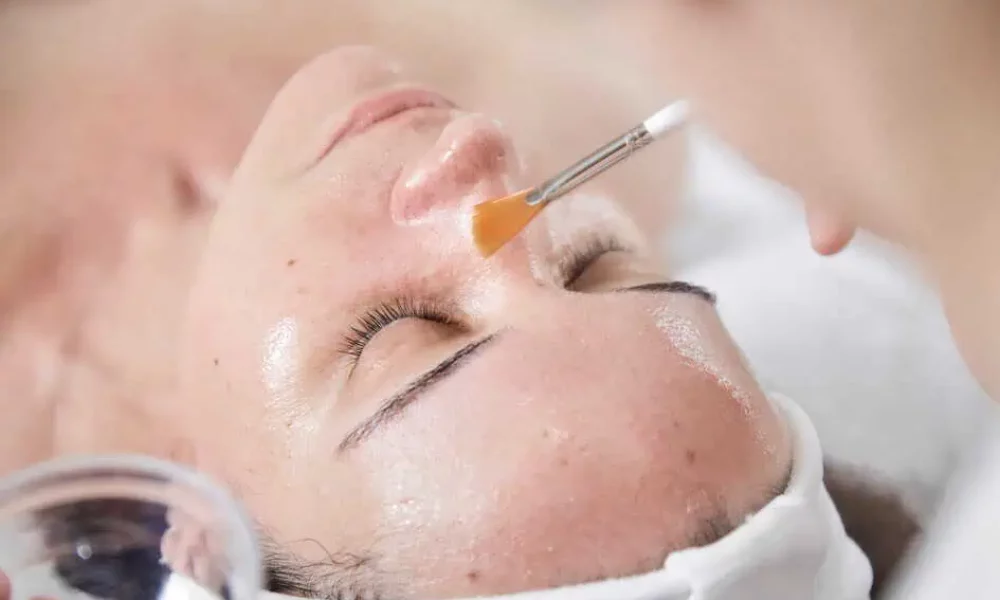 Chemical Peels in Sparta, NJ by Apres beauty and wellness LLC